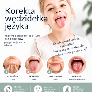 Jak ćwiczyć przed korektą wędzidełka języka?